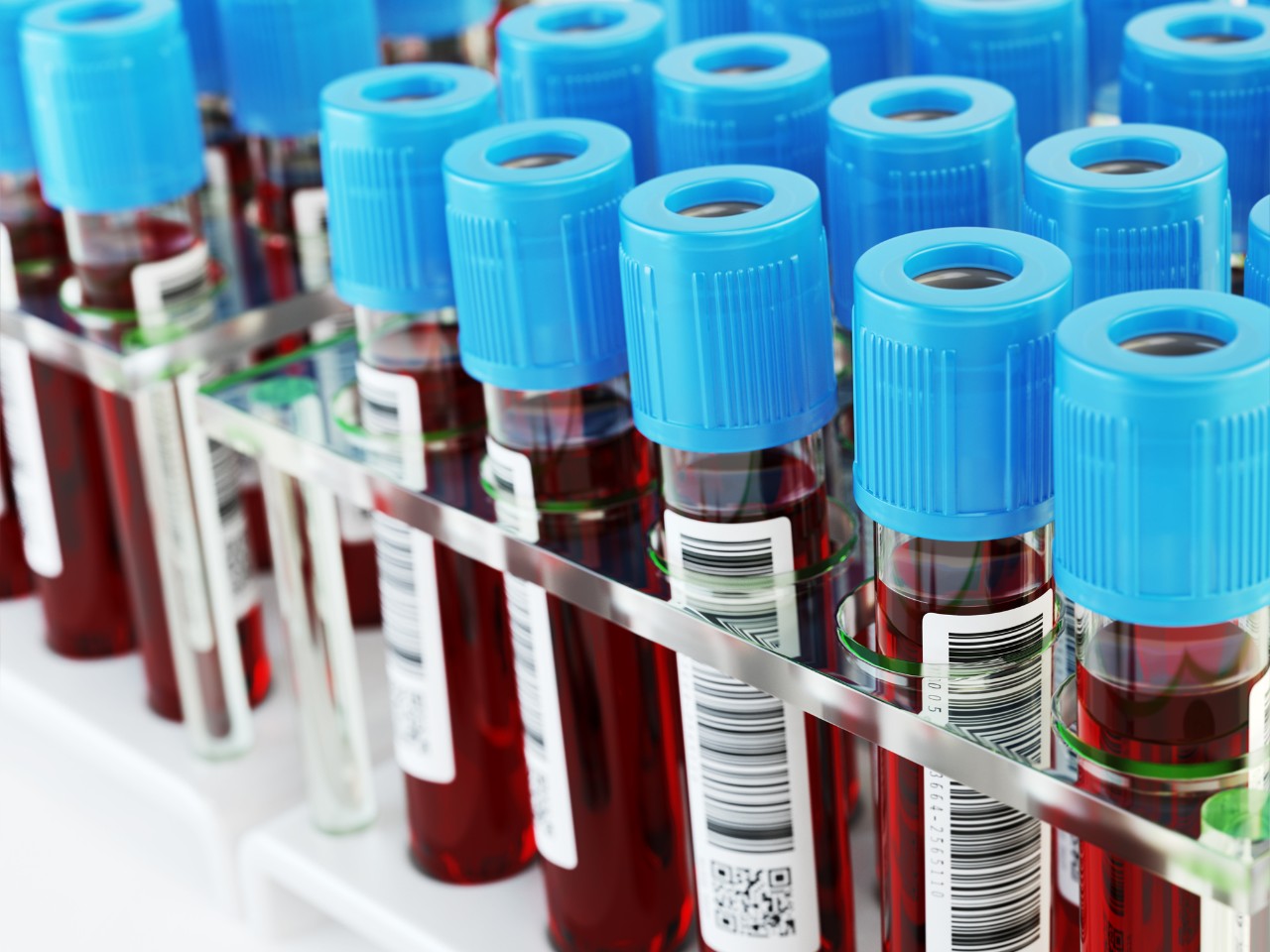 Rows of vials of blood